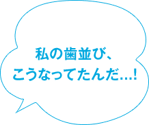 私の歯並び、こうなってたんだ...！