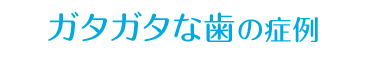 ガタガタな歯の症例