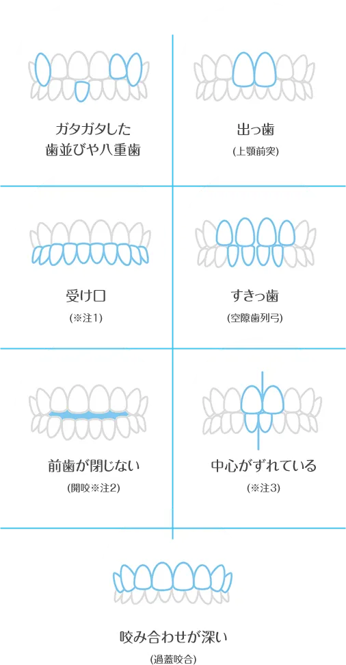 いろいろな歯並び