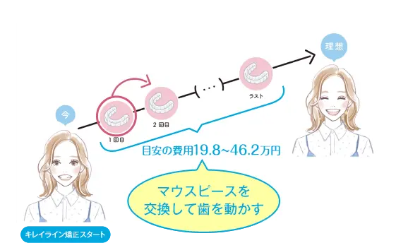 キレイライン矯正は、マウスピースを交換して、あなたの歯を少しずつ動かしていく治療法です。