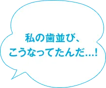 私の歯並び、こうなってたんだ...！