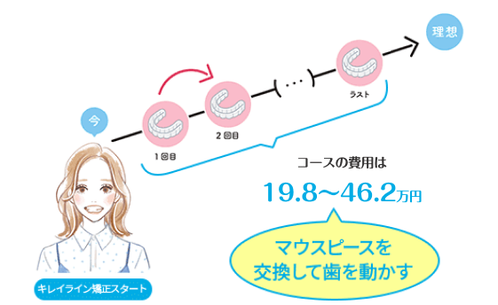 キレイライン矯正は、マウスピースを交換して、あなたの歯を少しずつ動かしてい治療法です。