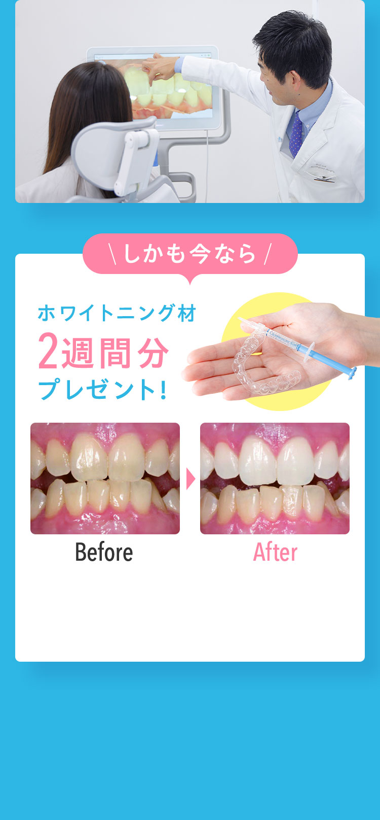 しかも今なら これから矯正を始める方へ