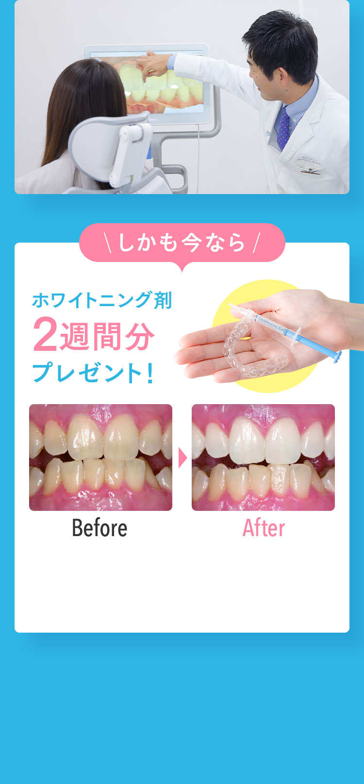 しかも今なら これから矯正を始める方へ
