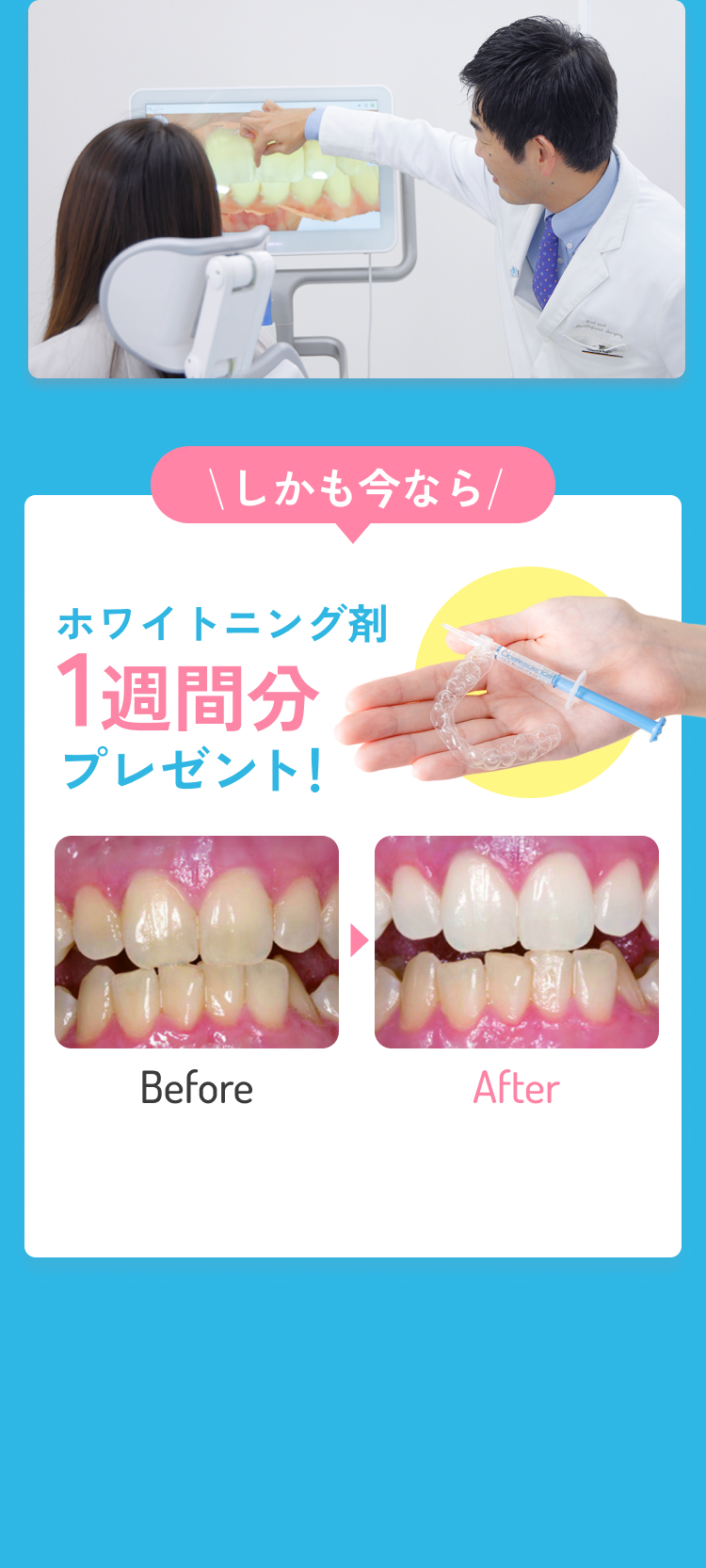 しかも今なら これから矯正を始める方へ