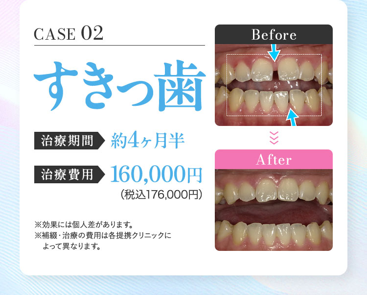 キレイラインが 評価される理由