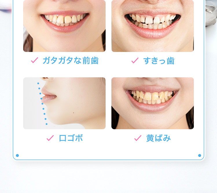 歯に関する悩みを まとめて矯正します