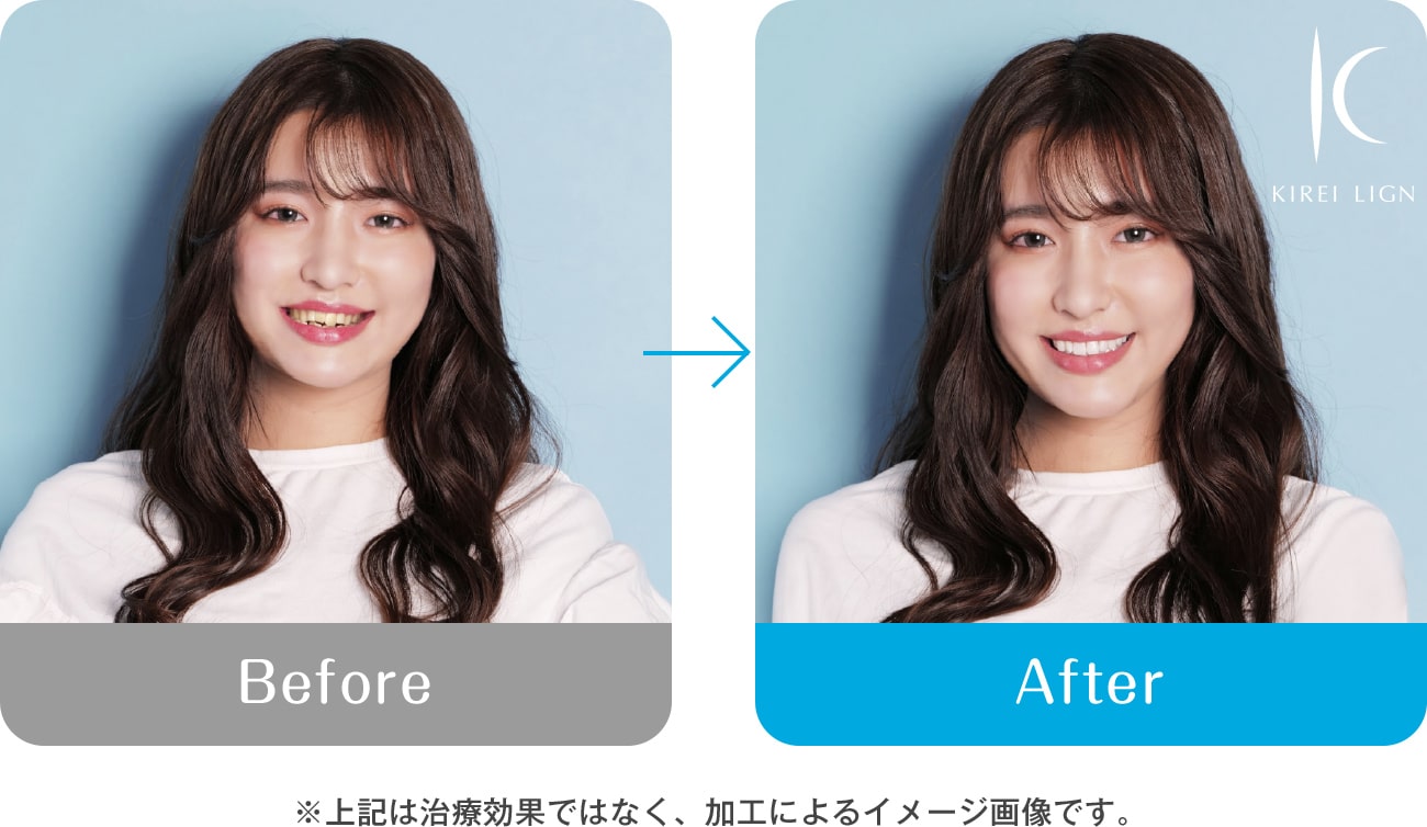 顔の印象が大きく変化するから。※治療効果ではなく、加工によるイメージ画像です。