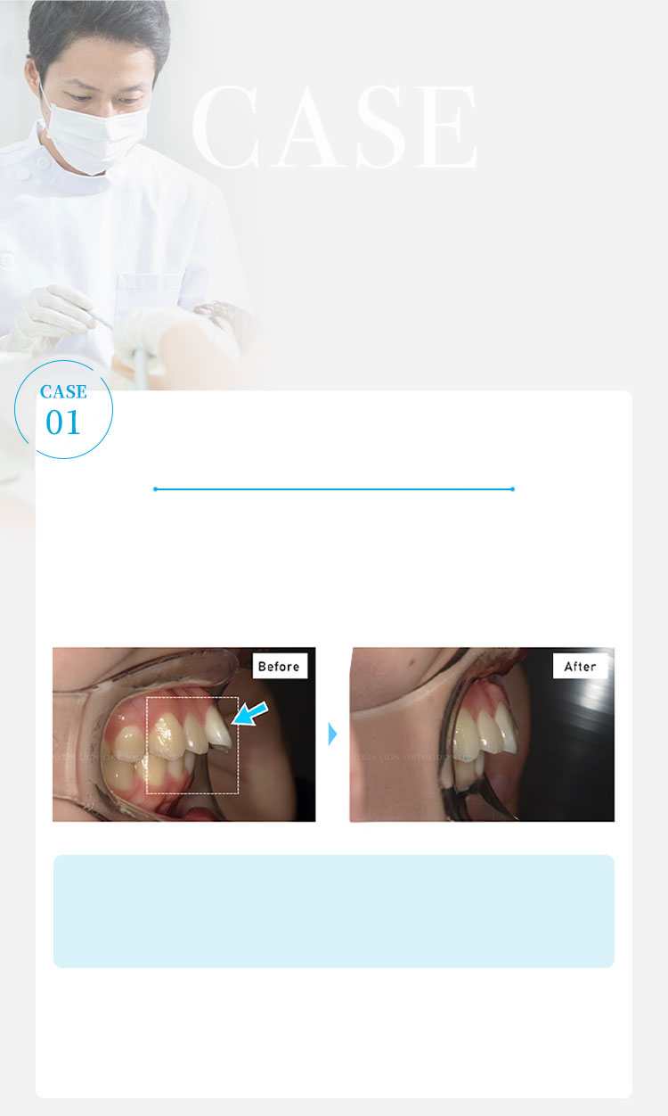 CASE 矯正治療の症例