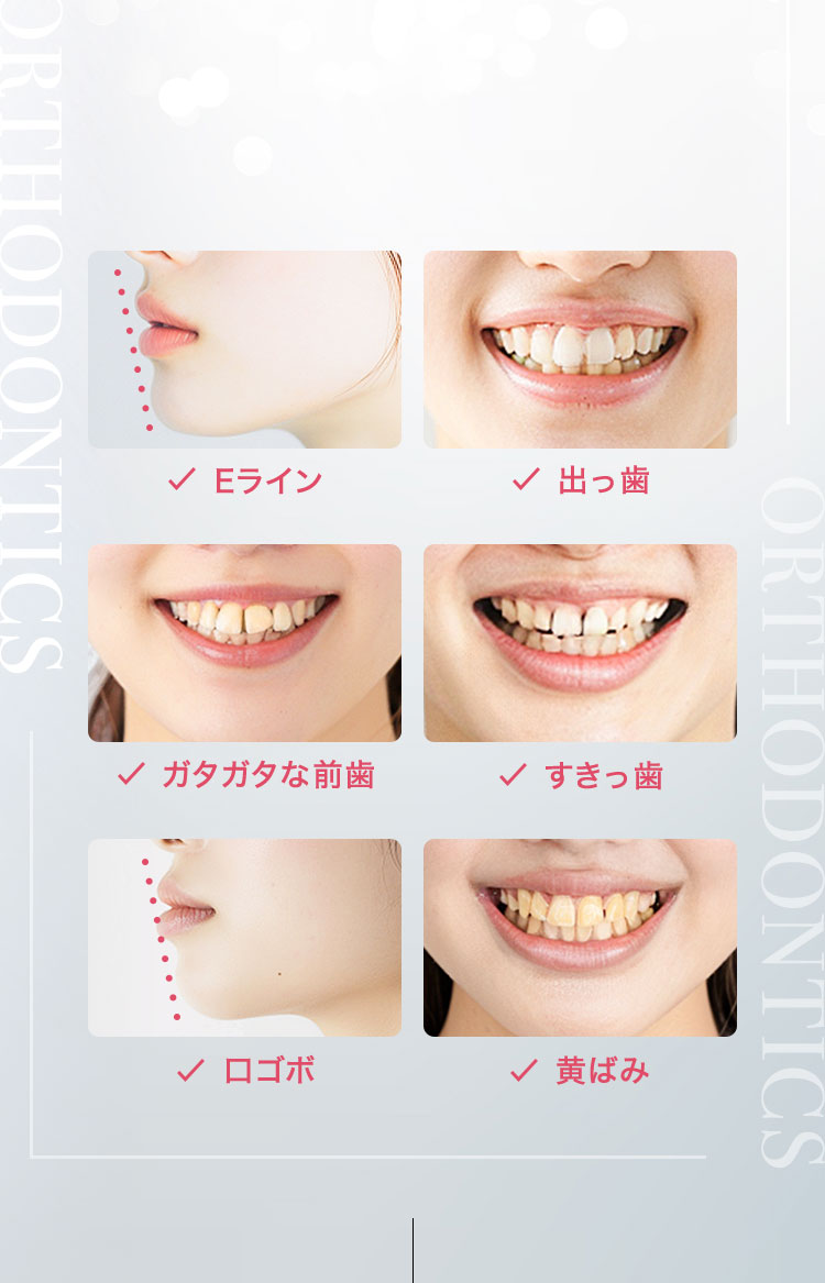 歯に関する悩みを まとめて矯正します
