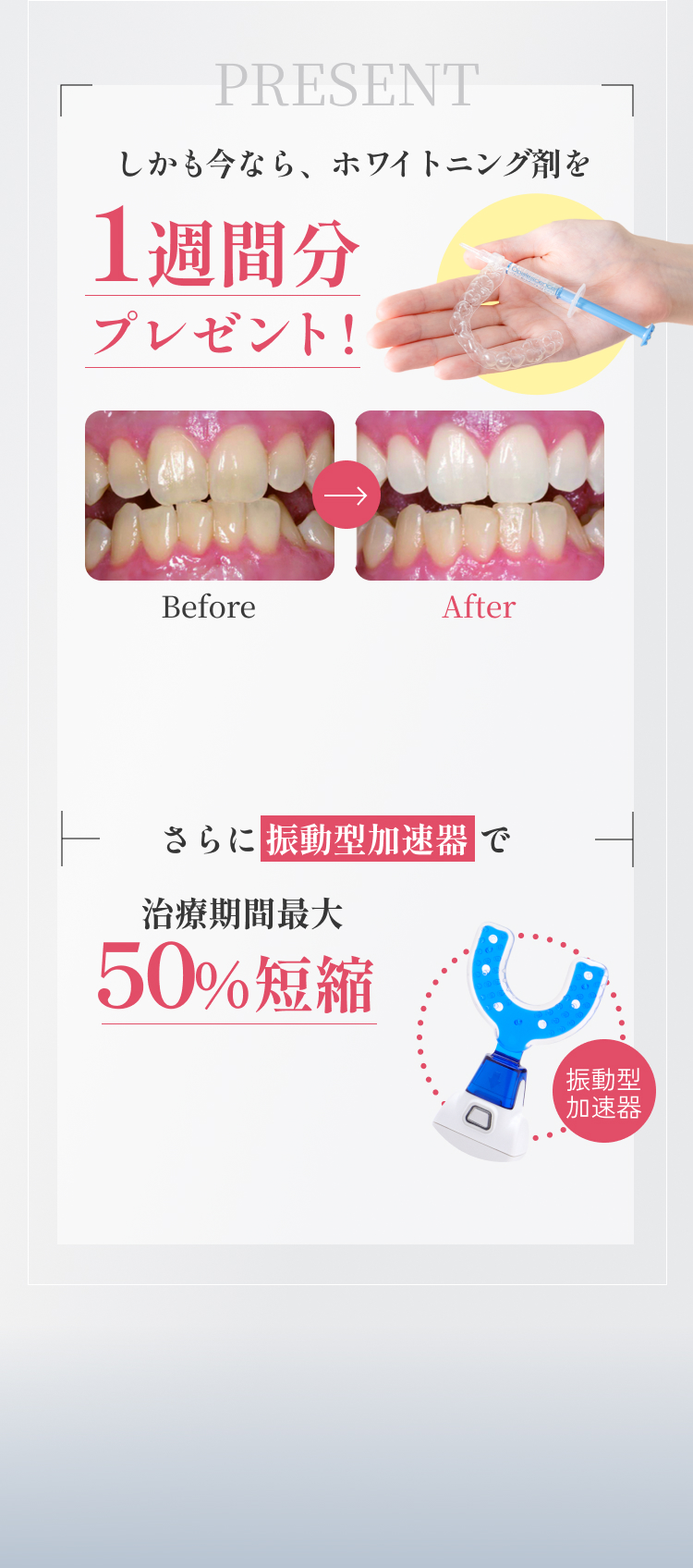 Present 2週間分 プレゼント！ 治療期間最大 50%短縮