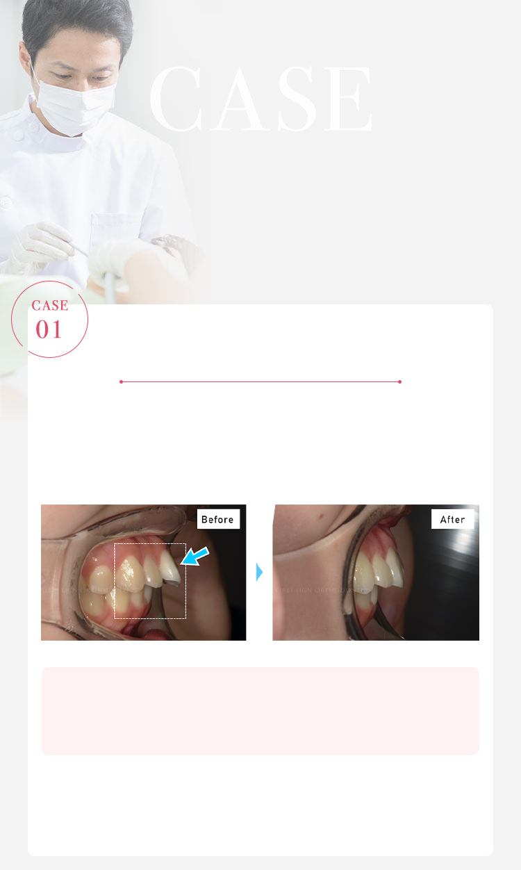 CASE 矯正治療の症例