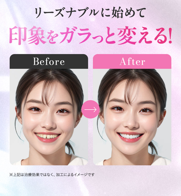 年齢を重ねるほど 歯は動きにくく なります