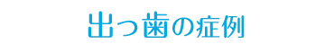 出っ歯の症例