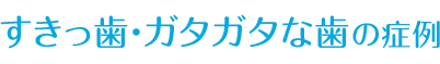 出っ歯の症例