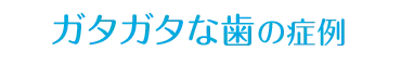 ガタガタな歯の症例