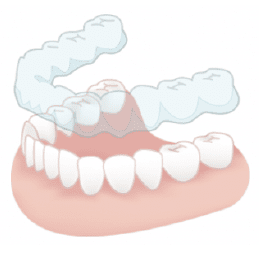 マウスピース矯正のイメージ画像