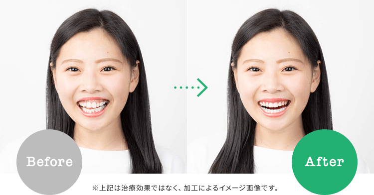 顔の印象のBefore・After