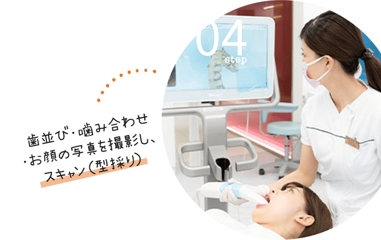 step04:歯並び・噛み合わせ・お顔の写真を撮影し、スキャン（型採り）