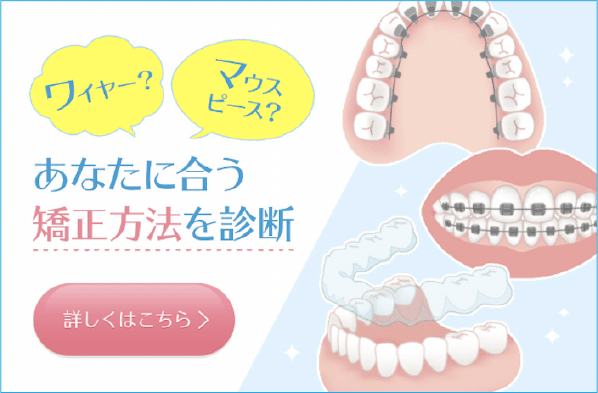 「あなたに合う矯正方法を診断！」詳しくはこちら