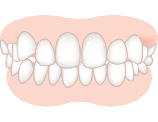 ガタガタの度合いが、軽度