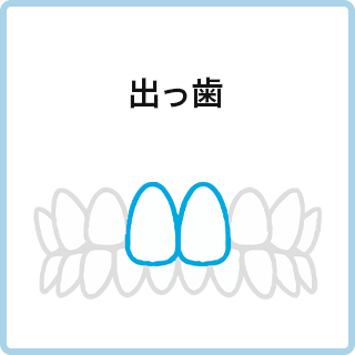 出っ歯