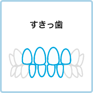すきっ歯