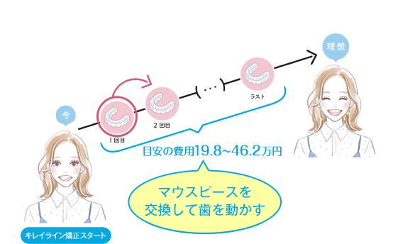 キレイライン矯正は、マウスピースを交換して、あなたの歯を少しずつ動かしていく治療法です。