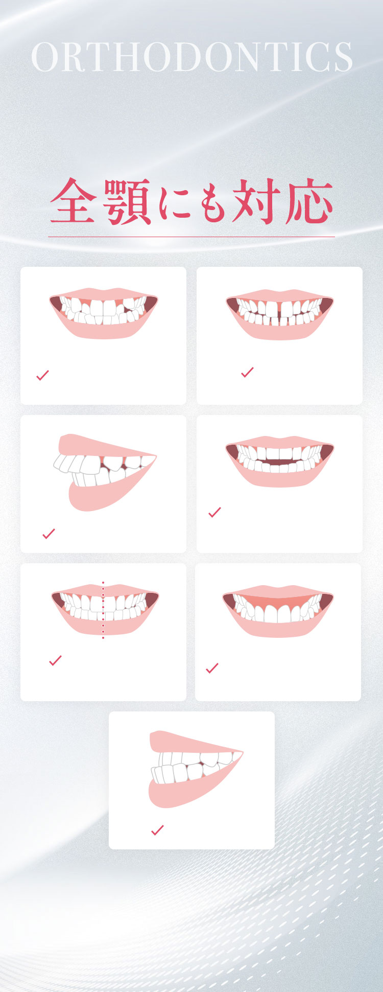 ガタガタの歯並び、八重歯、すきっ歯、出っ歯、開咬、受け口など様々な症例に対応