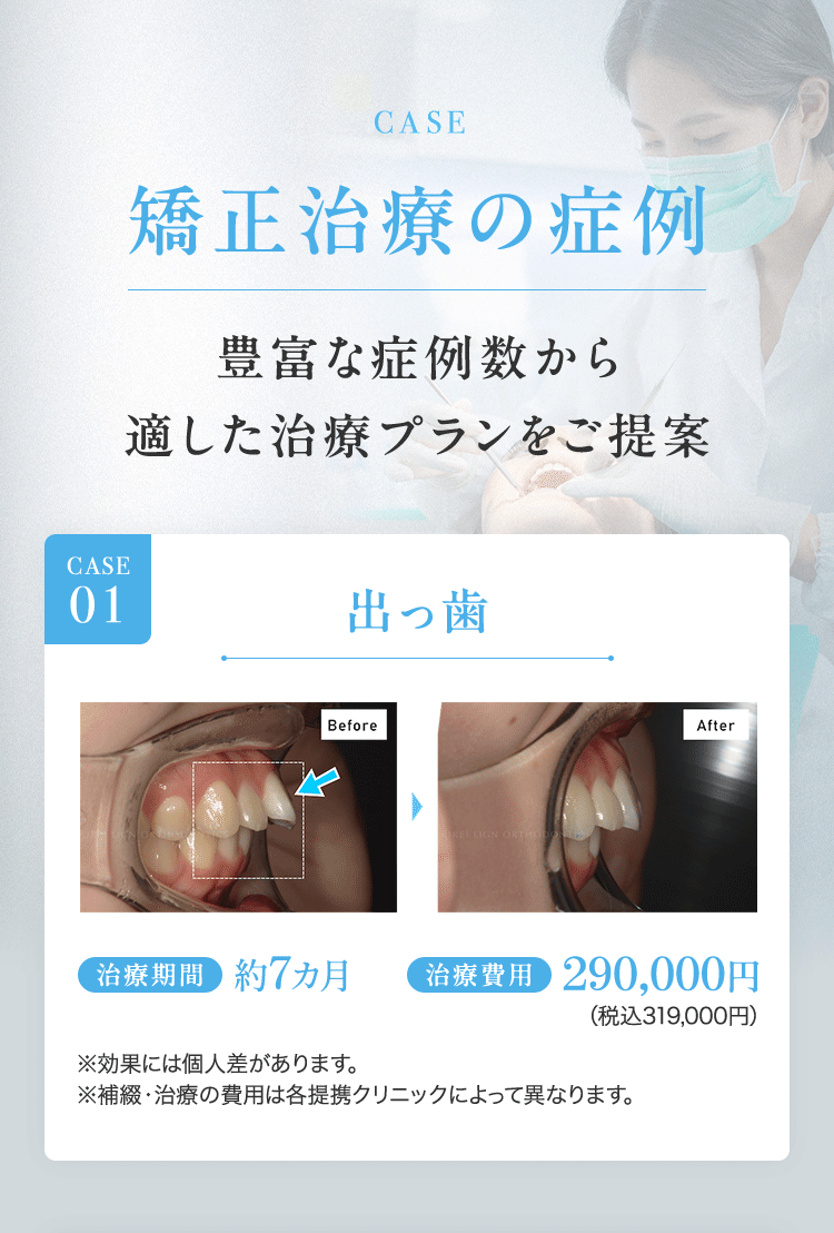 CASE 矯正治療の症例