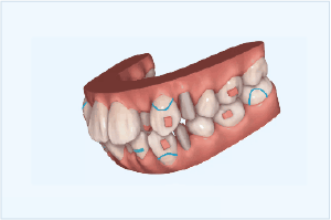 ３Dシミュレーション