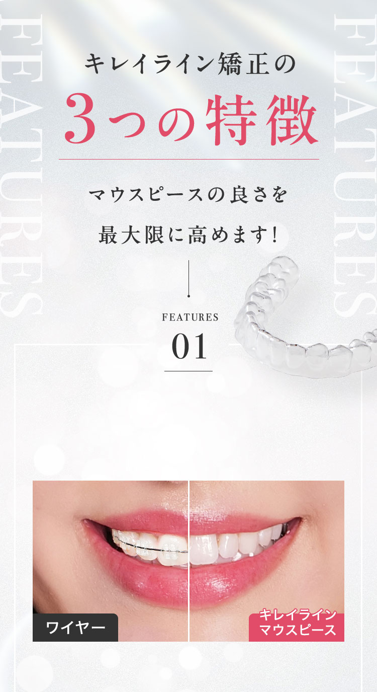 キレイライン矯正の3つの特徴「目立たない」「取り外せる」「痛みが少ない」