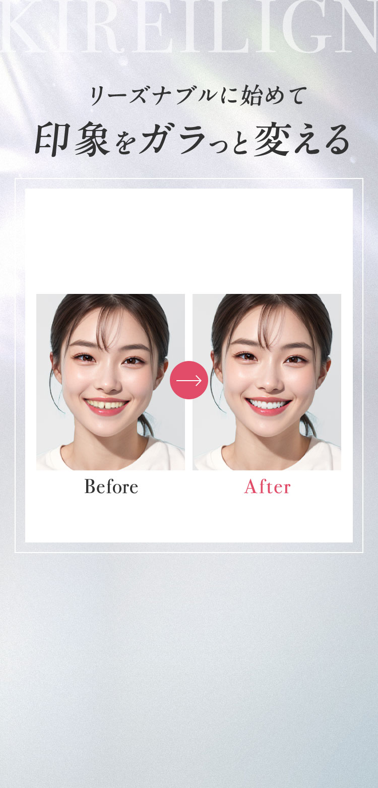 キレイラインであなた史上最も素敵な笑顔を手に入れる