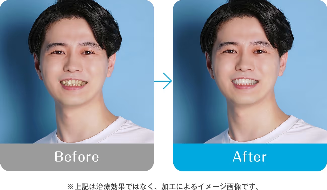 顔の印象が大きく変化するから。※治療効果ではなく、加工によるイメージ画像です。
