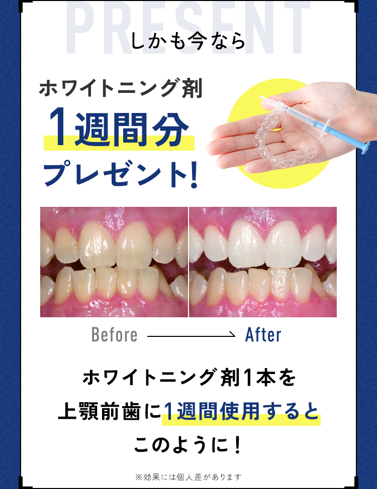 年齢を重ねるほど 歯は動きにくく なります