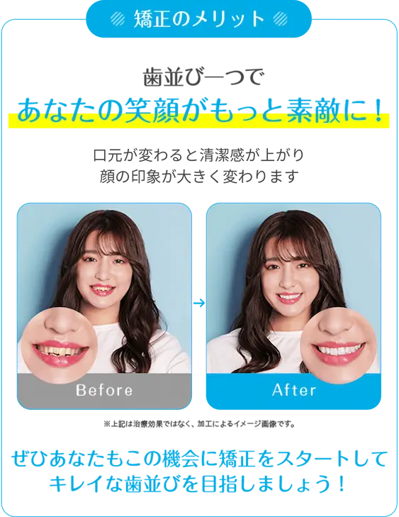 あなたの笑顔がもっと素敵に