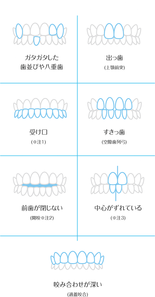 さまざまな歯並び