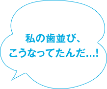 私の歯並び、こうなってたんだ...！