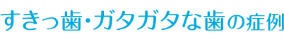 出っ歯の症例