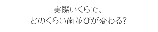 実際いくらで、どのくらい歯並びが変わる？