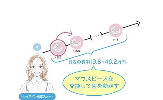 キレイライン矯正は、マウスピースを交換して、あなたの歯を少しずつ動かしていく治療法です。