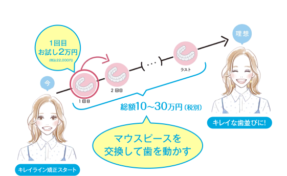 キレイライン矯正は、マウスピースを交換して、あなたの歯を少しずつ動かしてい治療法です。