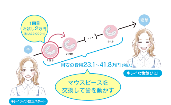 キレイライン矯正は、マウスピースを交換して、あなたの歯を少しずつ動かしてい治療法です。
