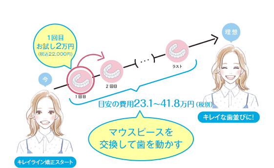 キレイライン矯正は、マウスピースを交換して、あなたの歯を少しずつ動かしてい治療法です。