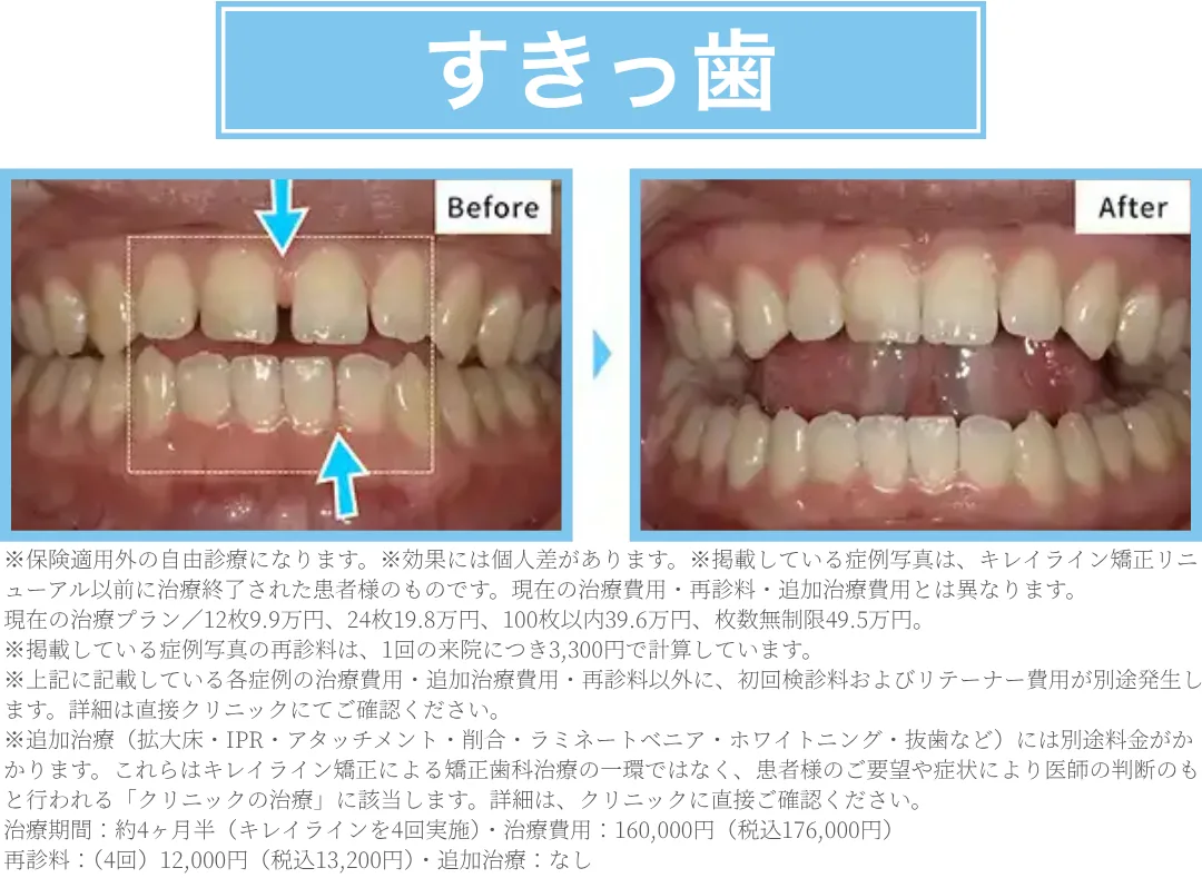 b463c325 23df8fbd 3874 433c 8fe5 cd1447658057