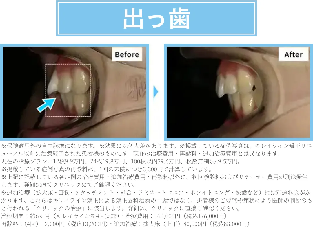 d5228f83 9105b1b5 08d5 4a18 a780 057e60f147d9