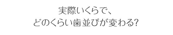 実際いくらで、どのくらい歯並びが変わる?