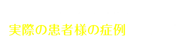 キレイライン矯正の実際の患者様の症例をチェック