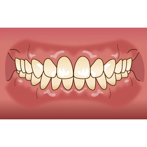 整った歯並びのイラスト