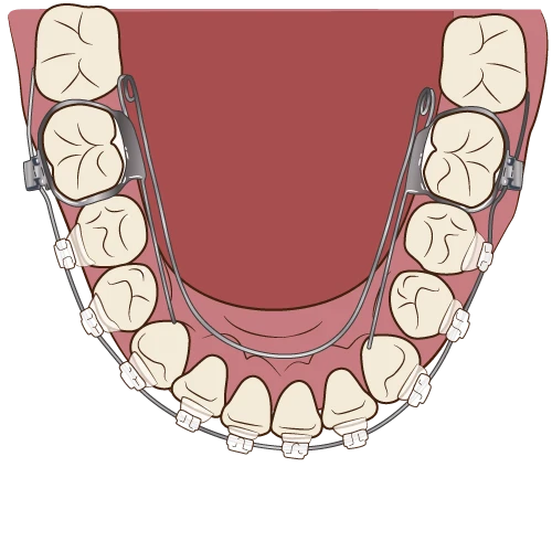 矯正後の整った歯並びのイラスト